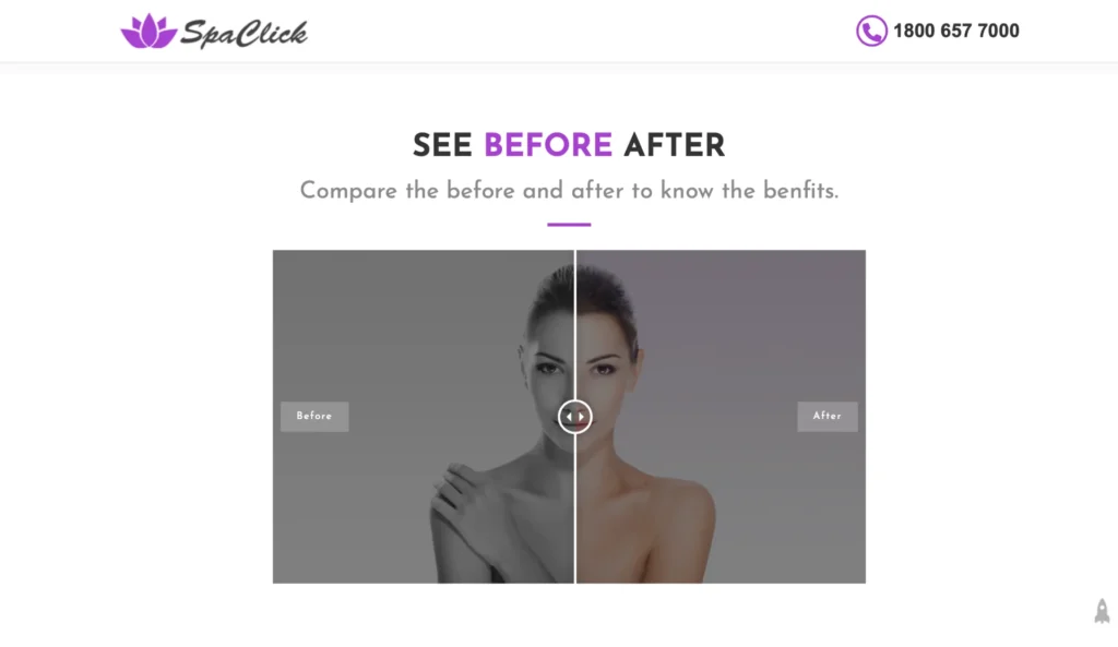 spa-before-after-comparison-slider